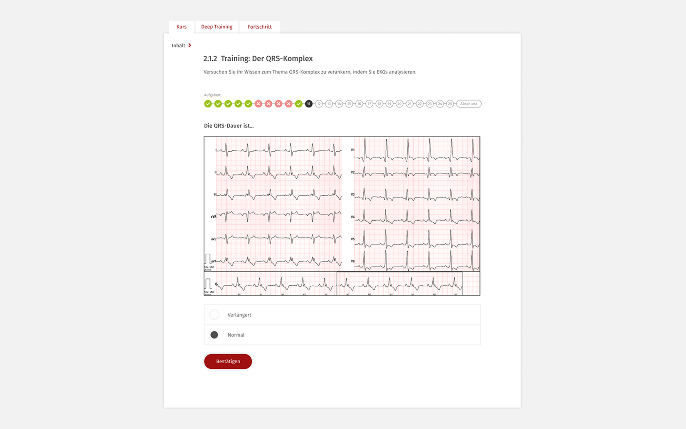 ekg.training screenshot
